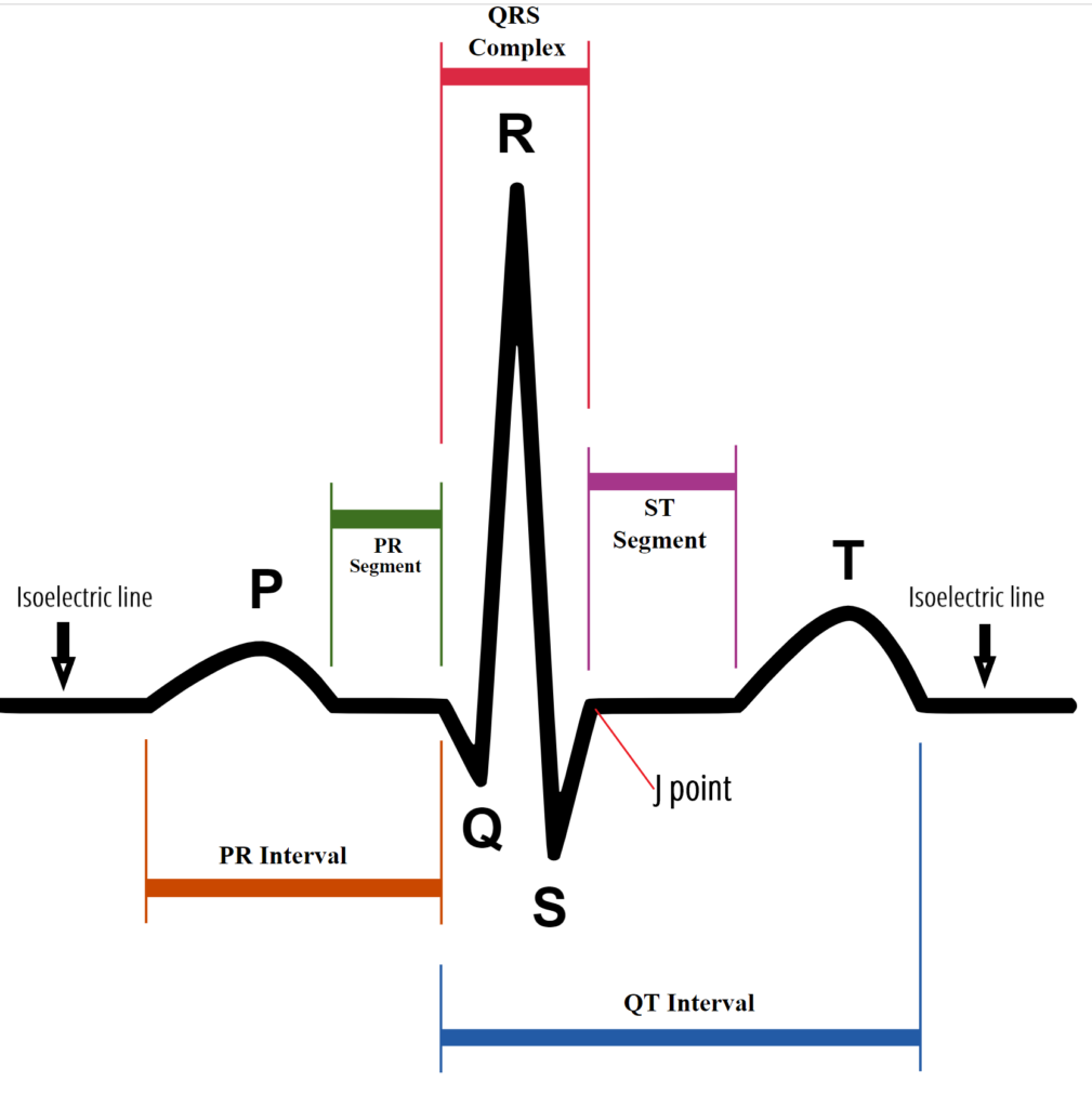 ECG Essentials – Health Education Collaborative