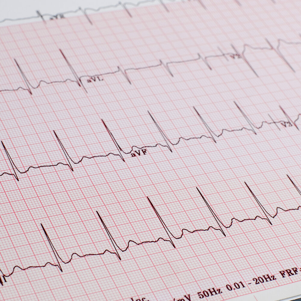 img-ecg